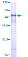 12.5% SDS-PAGE Stained with Coomassie Blue.